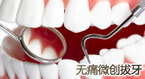 无痛拔牙